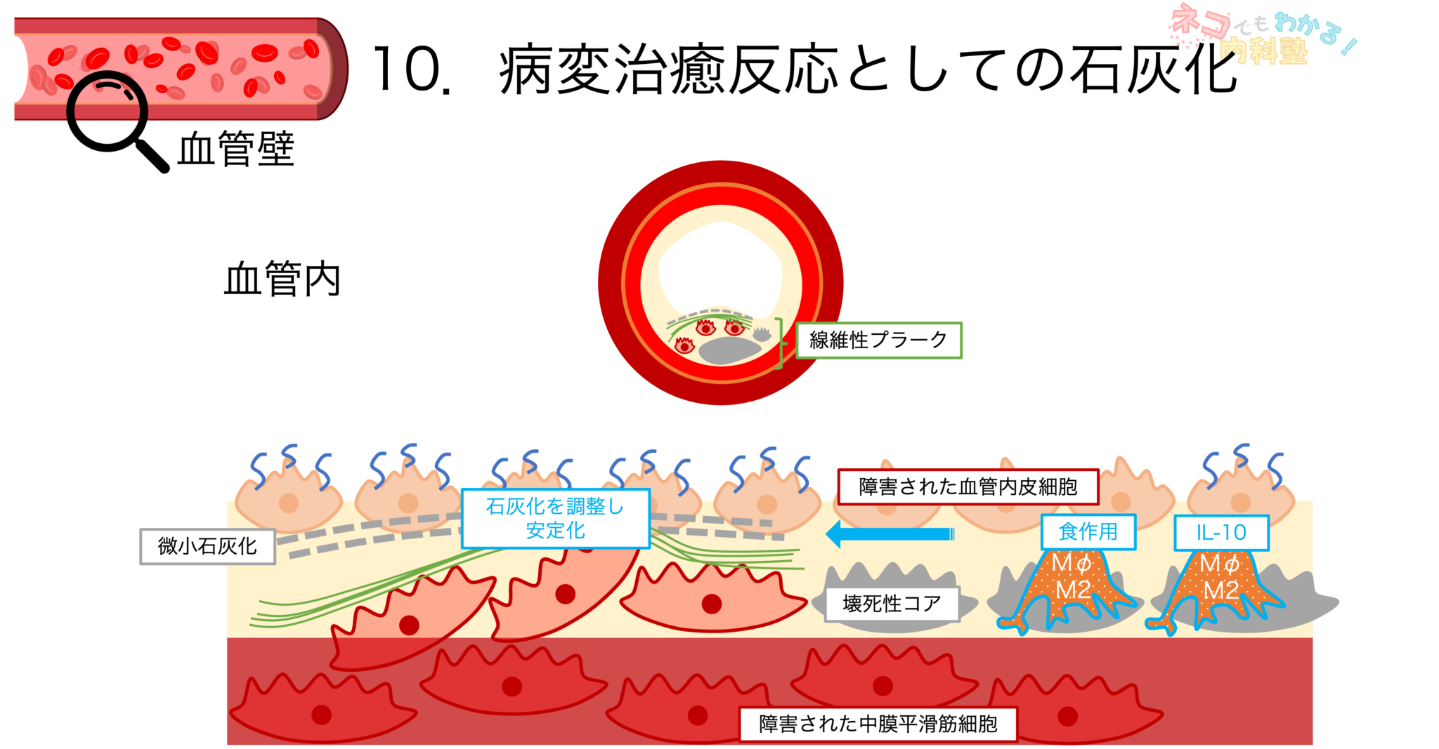 動脈硬化とは〈血管壁の構造,分類,形成メカニズム,プラーク〉|ネコでもわかる内科塾