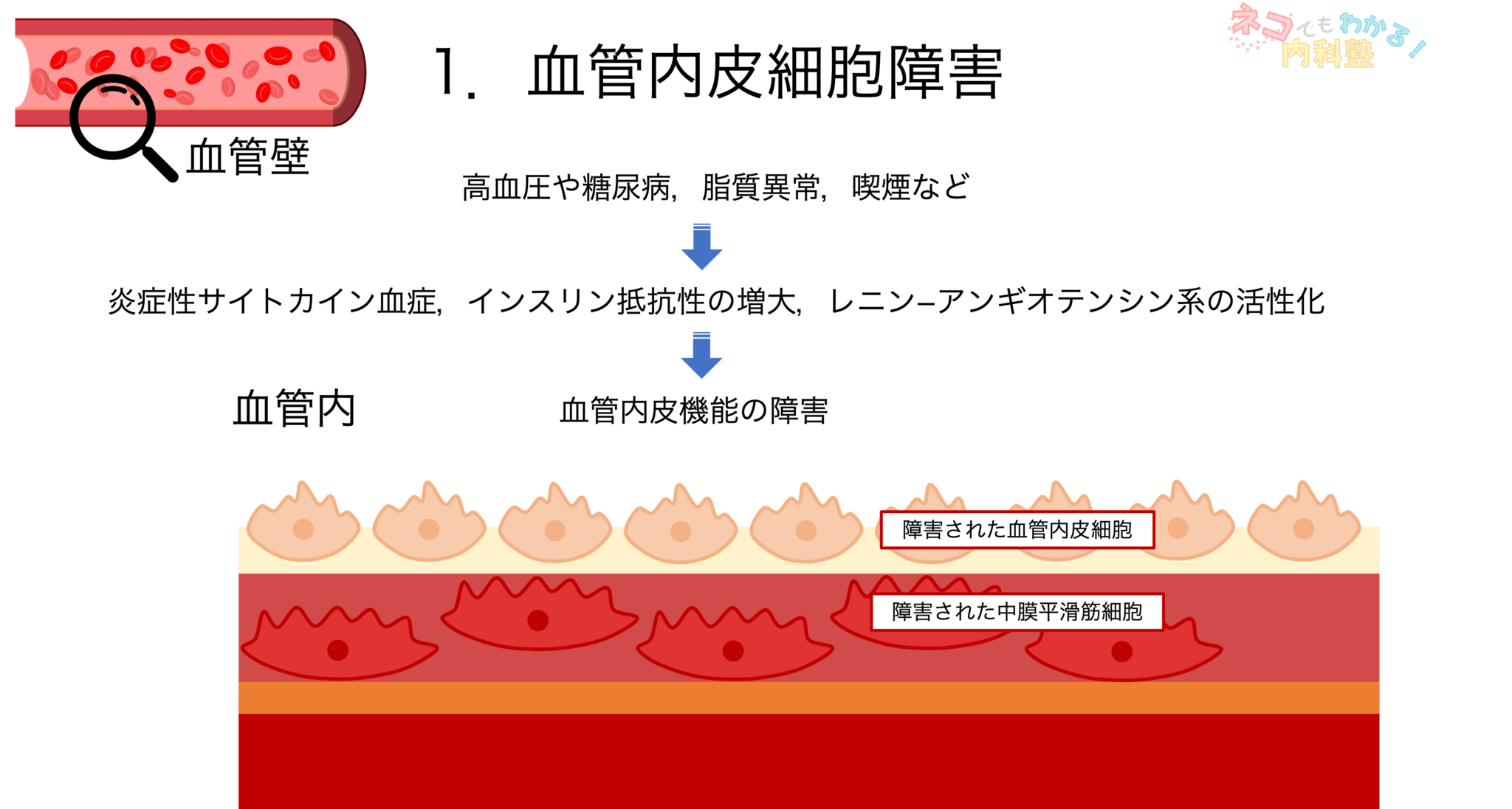 動脈硬化とは〈血管壁の構造,分類,形成メカニズム,プラーク〉|ネコでもわかる内科塾