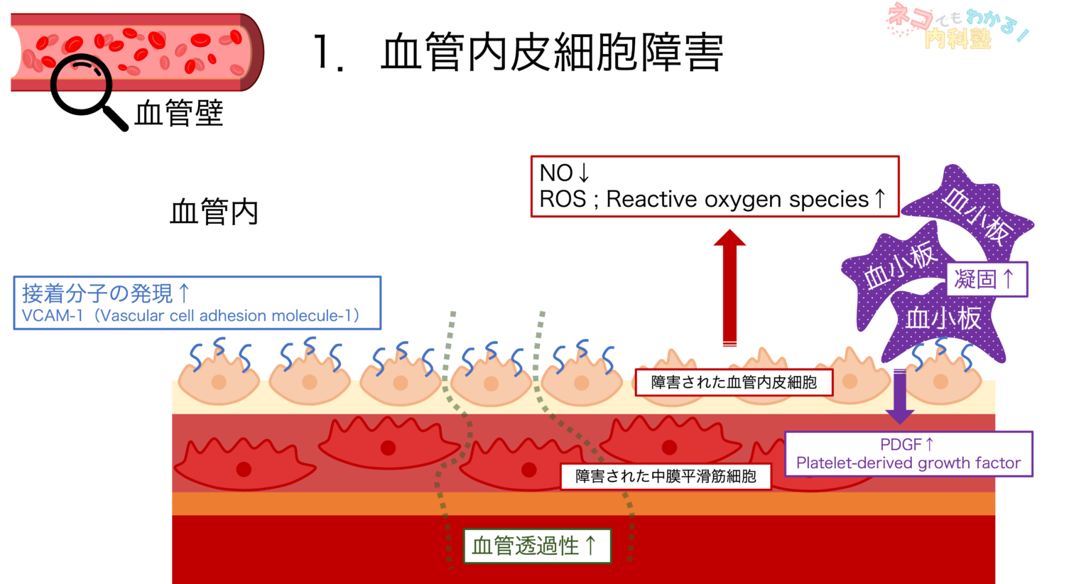 動脈硬化とは〈血管壁の構造,分類,形成メカニズム,プラーク〉|ネコでもわかる内科塾