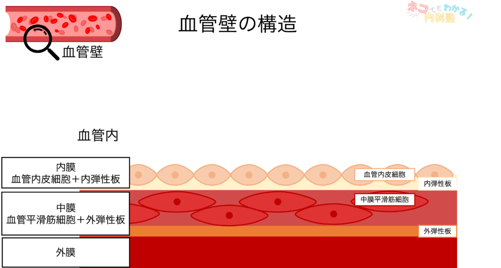 動脈硬化とは〈血管壁の構造,分類,形成メカニズム,プラーク〉|ネコでもわかる内科塾
