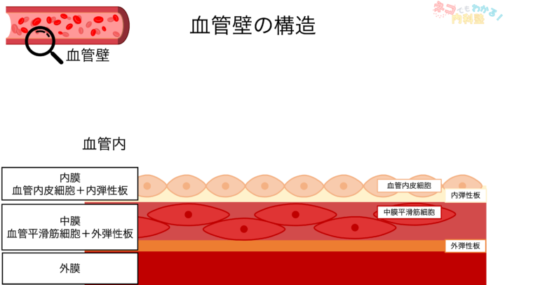 動脈硬化とは〈血管壁の構造,分類,形成メカニズム,プラーク〉|ネコでもわかる内科塾
